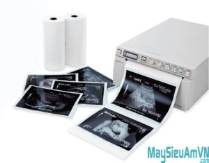 máy in nhiệt siêu âm sony