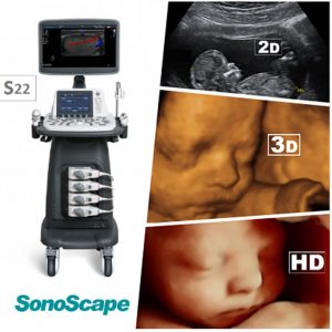 Hình siêu âm 2d,3d/4d,5d