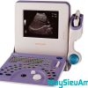 máy siêu âm xách tay aloka prosound 2