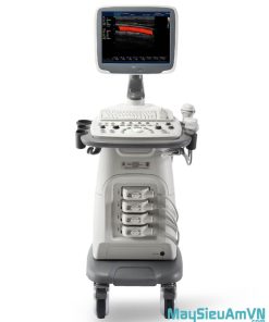 Sonoscape S11