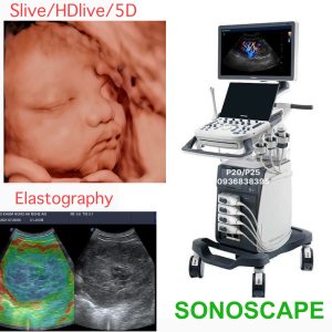 máy siêu âm 4D