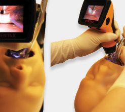 Máy đặt nội khí quản có camera