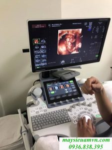 Máy siêu âm cũ Ge