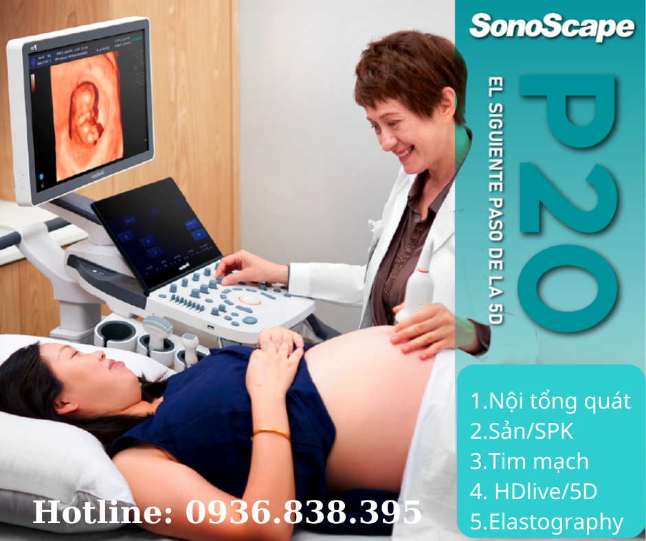 Máy sieu âm 5D Sonoscape P20