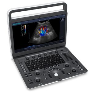 Máy siêu âm doppler màu