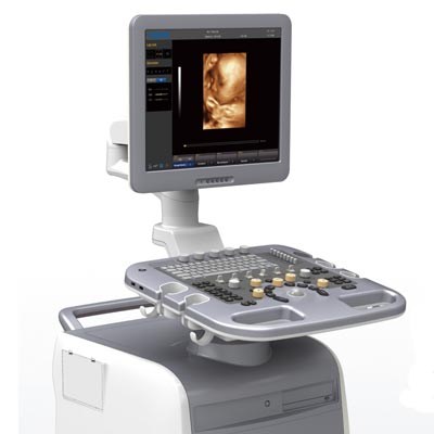 chison i3
