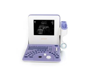 máy siêu âm xách tay Aloka