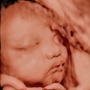 hình ảnh siêu âm 4d