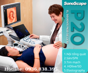 máy siêu âm Sonoscape P20