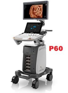 Máy siêu âm Sonoscape P60