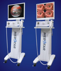 các loại máy nội soi tai mũi họng