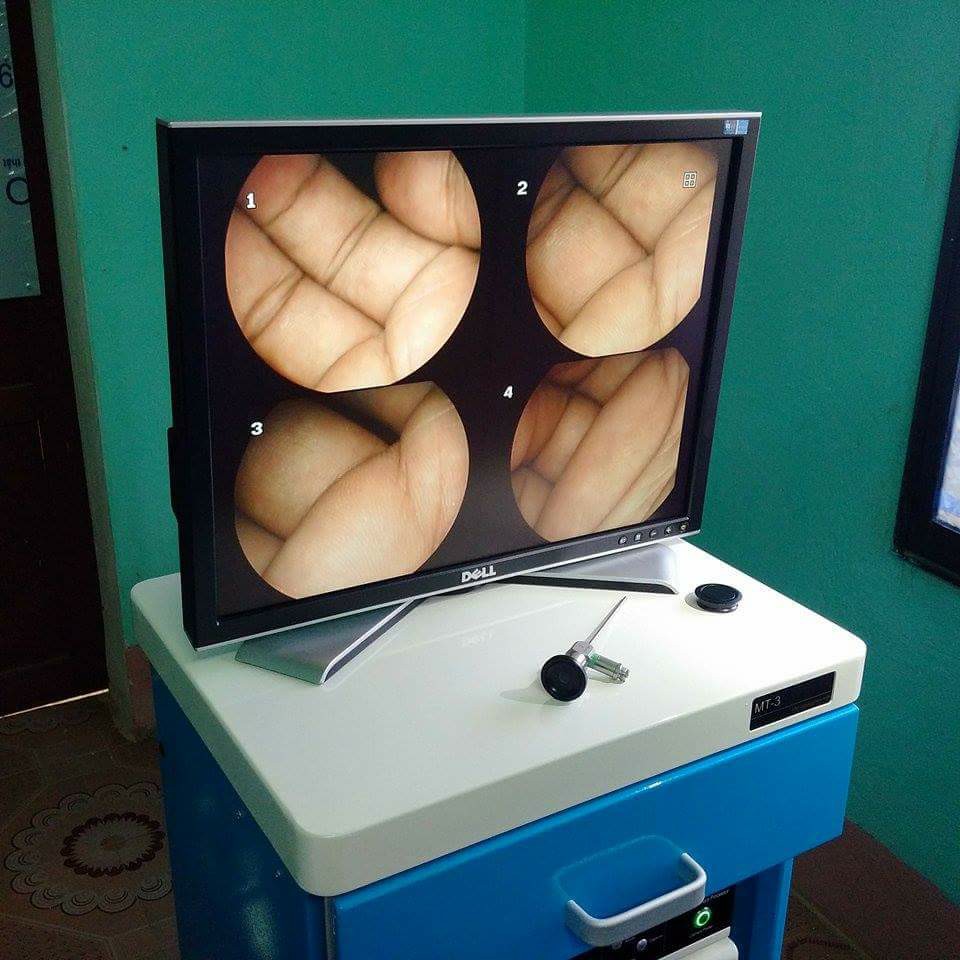 máy nội soi tai mũi họng giá rẻ