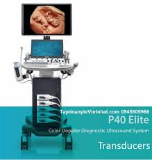sonoscape P40 Elite