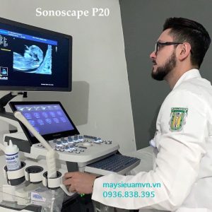 Máy siêu âm Sonoscape