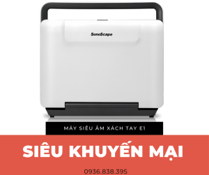máy siêu âm 2d