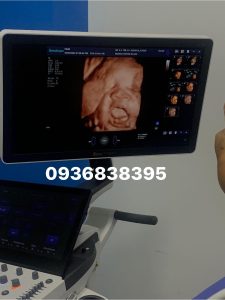 máy siêu âm trung quốc