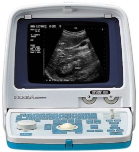 máy siêu âm HS2000