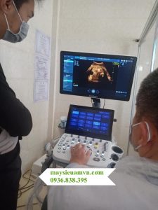 máy siêu âm ổ bụng