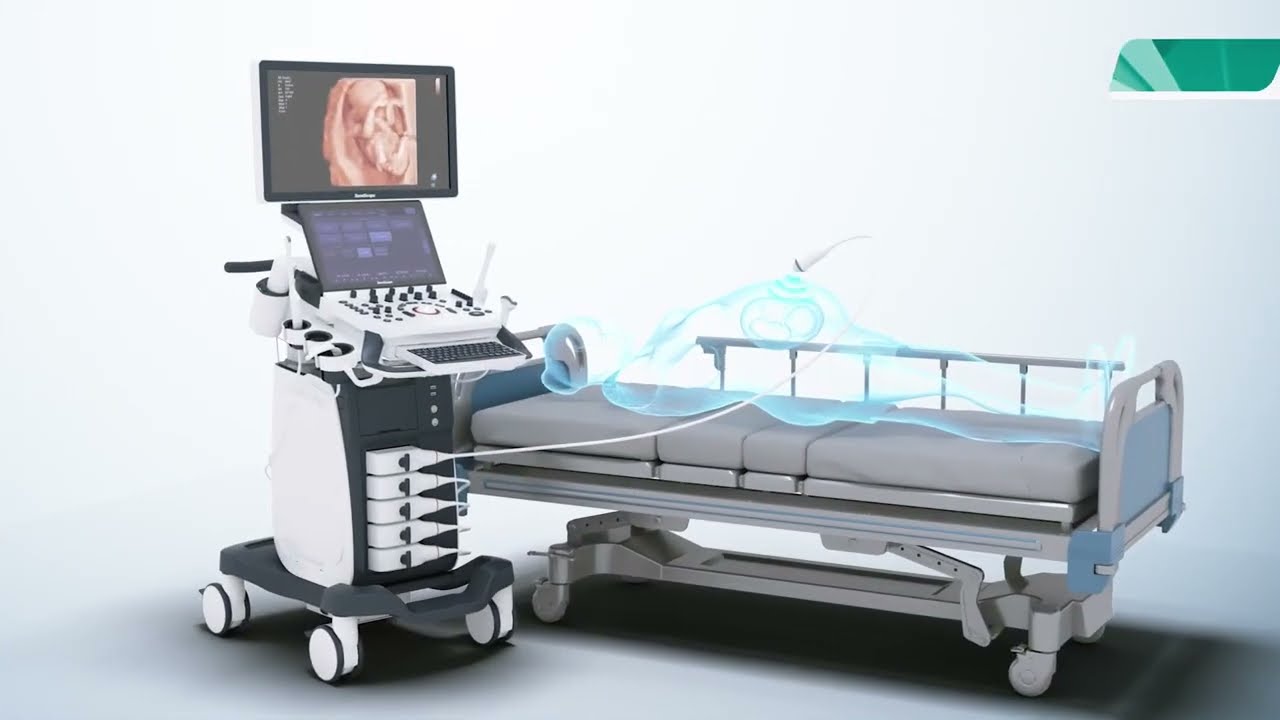 Khám phá đột phá công nghệ - Sonoscape P25 Pro và những điều bạn chưa biết
