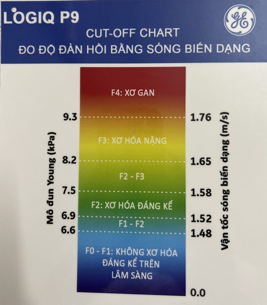Máy siêu âm đàn hồi mô gan Giải pháp tối ưu cho chẩn đoán bệnh gan