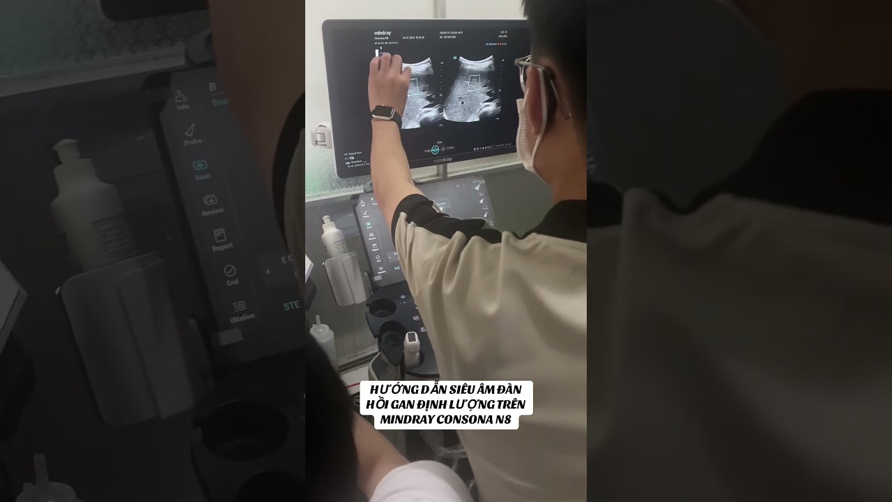 Máy siêu âm đàn hồi mô gan Giải pháp tối ưu cho chẩn đoán bệnh gan